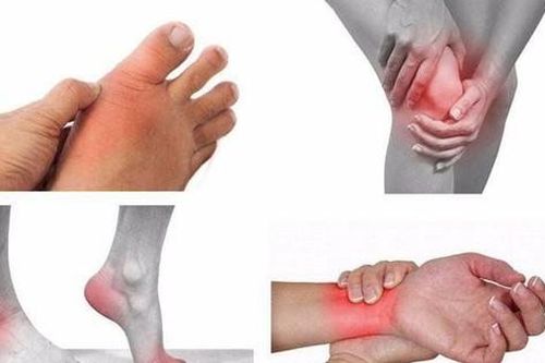 Cách phòng ngừa thoái hóa khớp