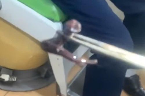 Người đàn ông bất ngờ bị đỉa rừng dài 7cm chui vào hốc mũi