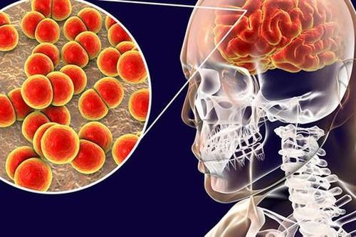 Quân nhân tử vong do nhiễm não mô cầu: Căn bệnh tử vong trong 24h