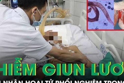 2 bệnh nhân nhiễm giun lươn gây hoại tử phổi nghiêm trọng
