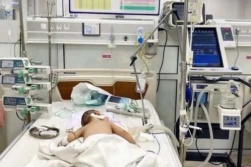 Cứu sống bé trai 7 tháng tuổi ở Phú Thọ bị suy hô hấp cấp do biến chứng cúm A