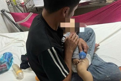Xác minh vụ bé 9 tháng tuổi bầm tím 2 má ở điểm trông trẻ, phải nhập viện