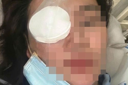Khởi tố kẻ 'bắt cá hai tay', đánh bạn gái chấn thương nặng ở TP.HCM