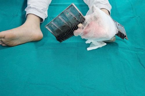 Bị thang cuốn kẹp vào chân, bé trai Hà Nội phải mổ cấp cứu