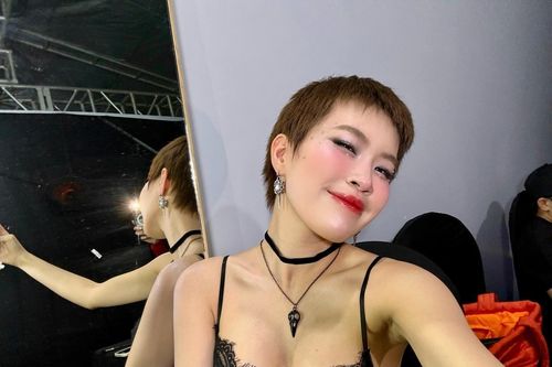 Rapper Pháo sau khi phẫu thuật thẩm mỹ