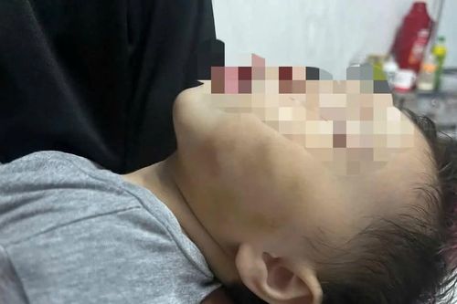 Vụ bé gái 9 tháng nghi bị bạo hành: Không có căn cứ để niêm phong gần 500 triệu
