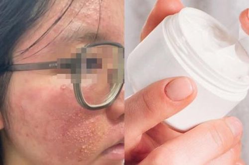 Cầu cứu bác sĩ sau 2 lần dùng món quà Valentine người yêu tặng