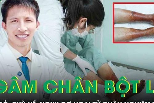 Phù nề, nguy cơ hoại tử hai bàn chân do ngâm chân bằng bột không rõ nguồn gốc