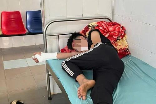 Nam sinh lớp 8 đánh học sinh lớp 10 gãy tay, vỡ đầu