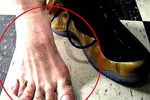 Câu tục ngữ nông thôn: 'Ngón chân thứ hai dài hơn ngón cái, lớn lên không hiếu thuận', đoán tính cách qua tướng ngón chân