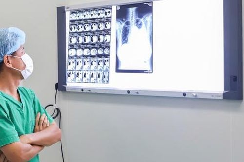 Phẫu thuật cứu cụ bà người Campuchia bị phình động mạch phổi hiếm gặp
