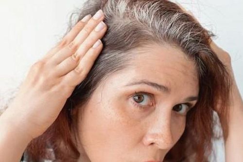 8 thực phẩm có thể giúp làm chậm quá trình tóc bạc sớm