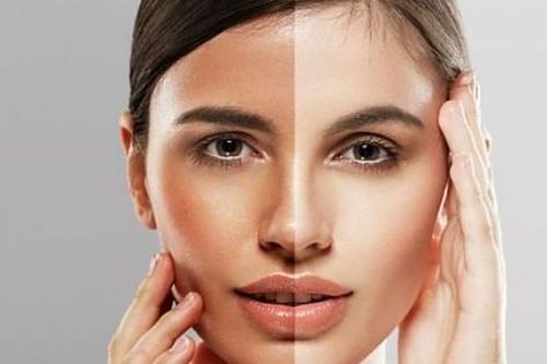 Sử dụng alpha arbutin làm trắng da như thế nào cho đúng?
