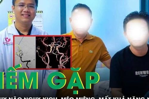 Bất ngờ méo miệng, mất khả năng nuốt, nam thanh niên đột quỵ não, tiên lượng nguy kịch