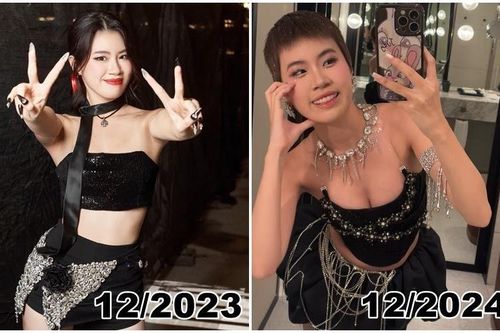 Rapper Pháo được nhận xét ngày càng thăng hạng sau phẫu thuật