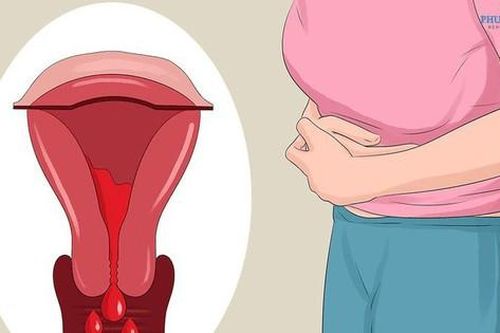 Câu hỏi thường gặp liên quan đến cường kinh