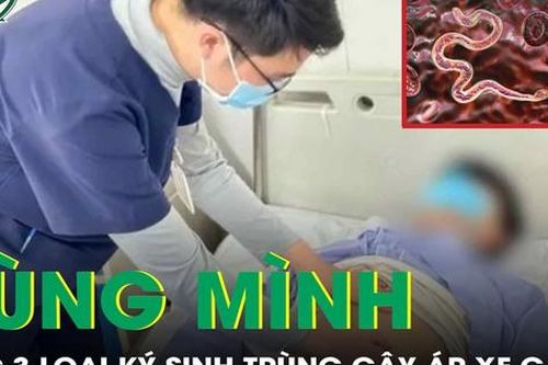 Nam thanh niên mắc 3 loại ký sinh trùng cùng lúc, tàn phá gan nặng nề