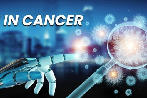 Phân tích máu bằng AI mở ra một cuộc cách mạng trong phát hiện ung thư sớm