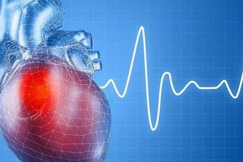 6 câu hỏi thường gặp liên quan đến Hội chứng QT kéo dài