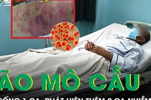 Cứu sống bệnh nhân mắc não mô cầu, khoanh vùng phát hiện thêm 2 ca mới
