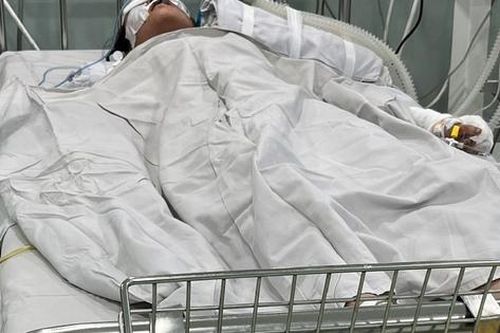 Vụ cháy tiệm bánh kem ở TPHCM: 4 bệnh nhân phải thở máy
