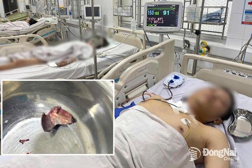 Báo động đỏ toàn bệnh viện, cứu sống ngoạn mục bệnh nhân ở Biên Hòa bị thương ở mạch máu cổ rất nguy kịch