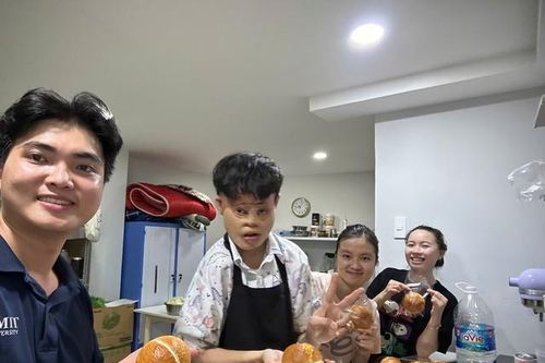 Tái tạo thần kỳ cho những bệnh nhân có gương mặt biến dạng vì bỏng