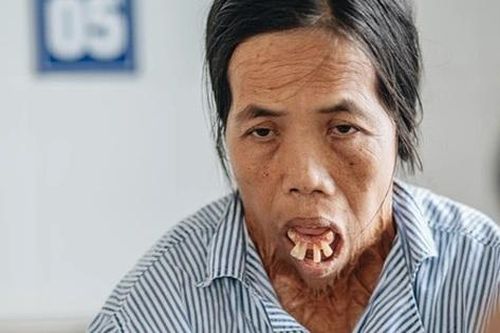 Cuộc sống mới của người phụ nữ hơn nửa thế kỷ không ngậm được miệng, không ngoái được cổ
