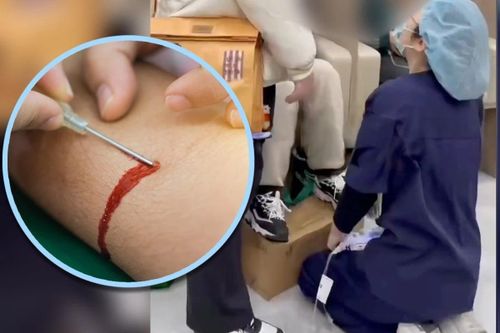 Clip 100 triệu view gây phẫn nộ với cảnh y tá bị ép quỳ vì rút kim làm chảy máu