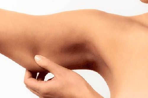 4 lý do cản trở việc giảm cân ở tuổi trung niên