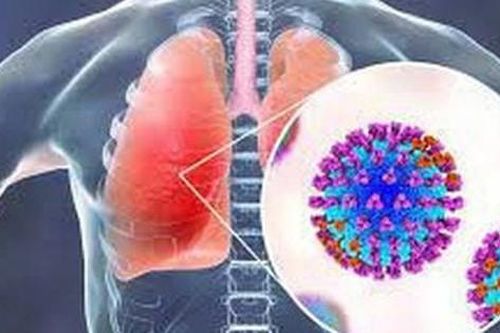 Chưa quan tâm đúng mức đến bệnh nấm phổi