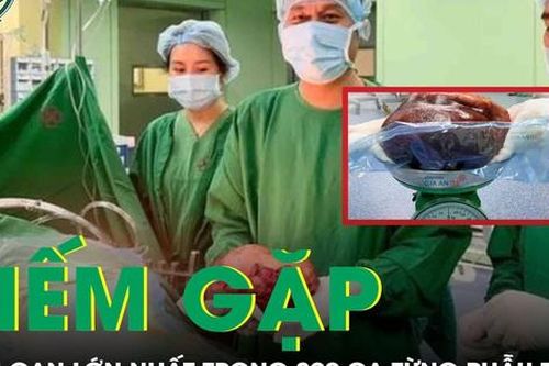 Cắt u gan khủng nhất trong hơn 300 ca bệnh viện từng tiếp nhận