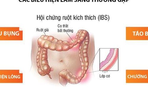 7 liệu pháp giúp tiêu hóa tốt, tăng cường sức khỏe đường ruột