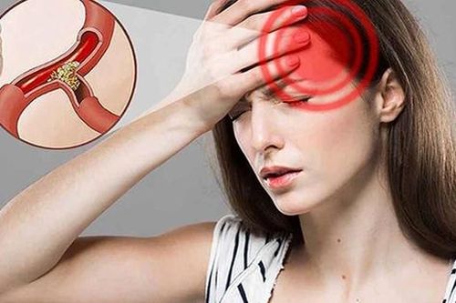 Cách giảm nguy cơ thiếu máu lên não hiệu quả