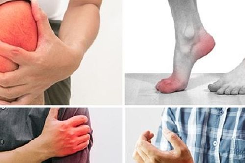 Bảo vệ xương khớp trong mùa đông