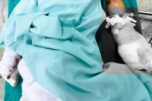 Học sinh lớp 6 nát bàn tay do chế tạo pháo
