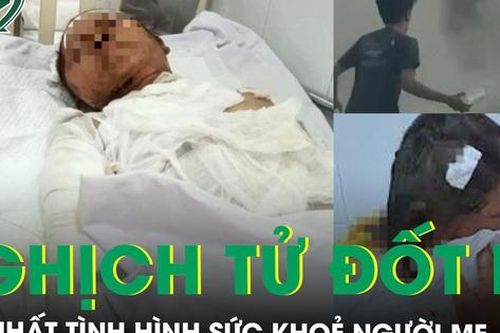 Mới nhất tình hình sức khỏe người mẹ trong vụ 'nghịch tử' tẩm xăng thiêu sống mẹ