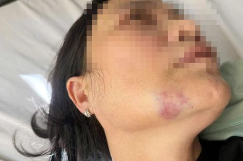 Công an tỉnh Gia Lai vào cuộc làm rõ vụ nhân viên y tế bị đánh nhập viện