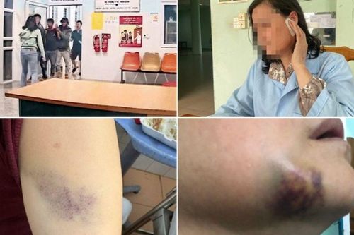 Nữ y sĩ bị 3 người đàn ông đánh hội đồng: Hỏi vì sao chửi bác sĩ là chó mèo thì bị đánh hội đồng