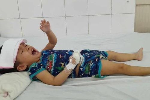 Bé gái 3 tuổi phải trải qua 7 ca phẫu thuật giành lại sự sống