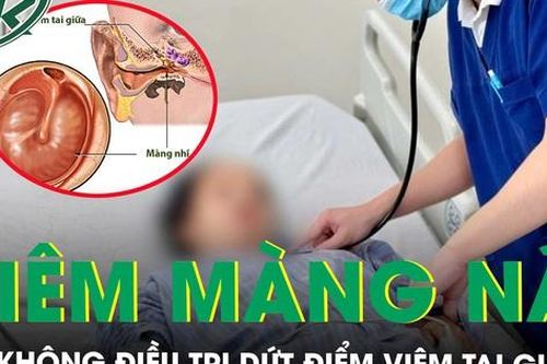 Viêm tai giữa không điều trị dứt điểm, người phụ nữ hôn mê sâu do viêm màng não