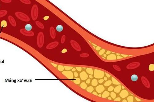 5 chất dinh dưỡng giúp loại bỏ cholesterol xấu