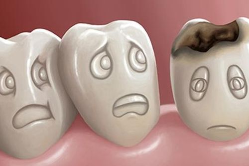 Nhận biết sâu răng giai đoạn sớm
