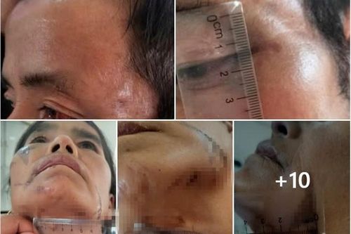 Người phụ nữ bị treo lên cây, hơ dao nóng vì nghi bỏ bùa