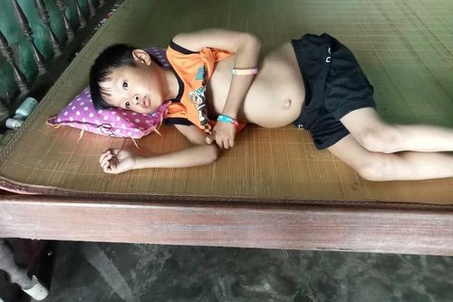 Người mẹ từng mất 2 con cầu xin cứu giúp đứa còn lại mắc bệnh hiểm nghèo