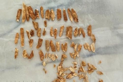 Phát hiện bất ngờ về bộ xương lai giữa người Neanderthal và người hiện đại