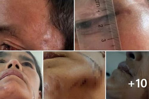 Vụ bắt giữ người vì nghi bị bỏ bùa ở Điện Biên: Chính quyền nói gì?