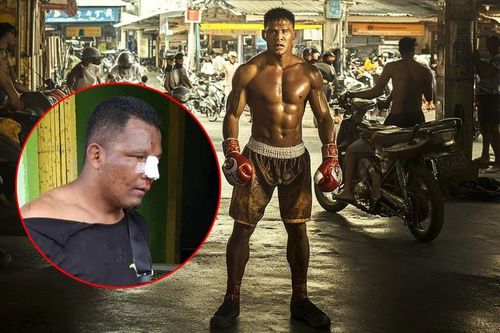Hành hung nhân viên bảo vệ, cao thủ 2 môn võ bị đánh bầm dập