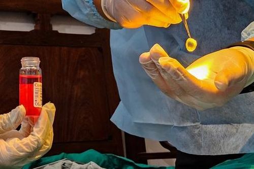 Từ phương Nam, con trai kết nối ra Hà Nội để thực hiện di nguyện của bố: Hiến giác mạc khi qua đời