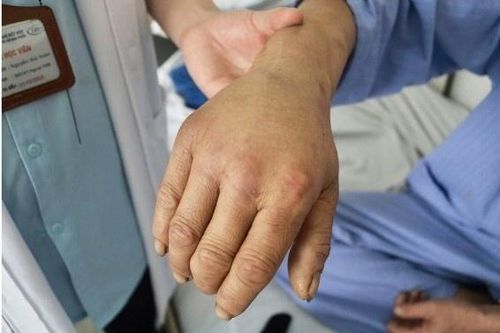 Tin lời 'thần y', người đàn ông nhập viện trong đau đớn